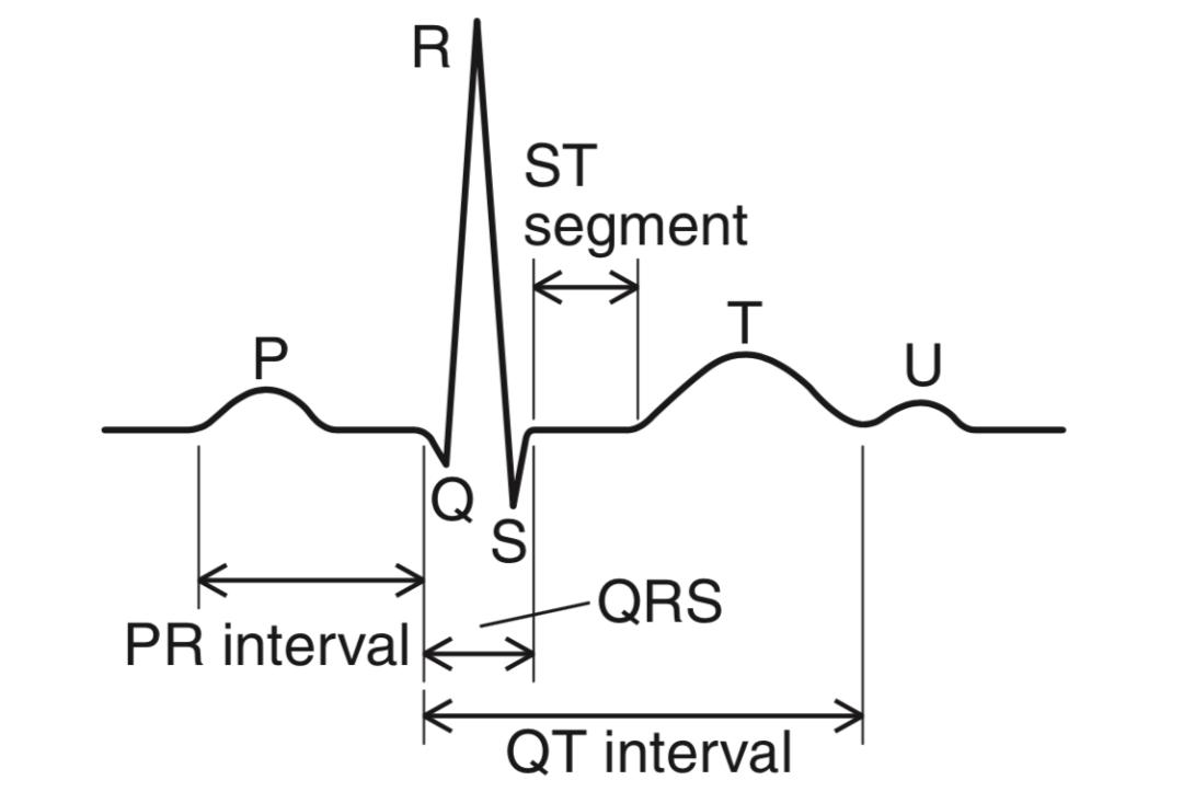 心电图的st向量怎么看,心电图中的sv1代表什么