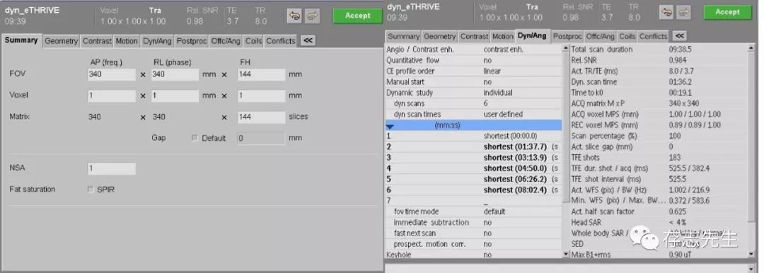 乳腺磁共振亲身经历,磁共振乳腺动态增强扫描全过程