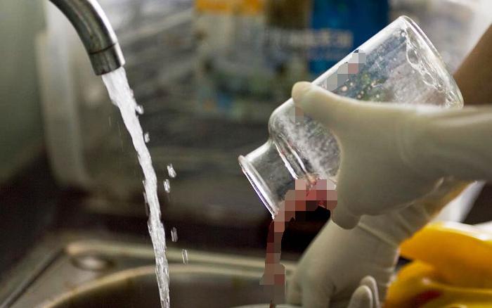 49天内人流的过程,睡一觉醒来流产