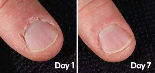 珂润跟片仔癀哪个好,片仔癀和珂润哪个好用