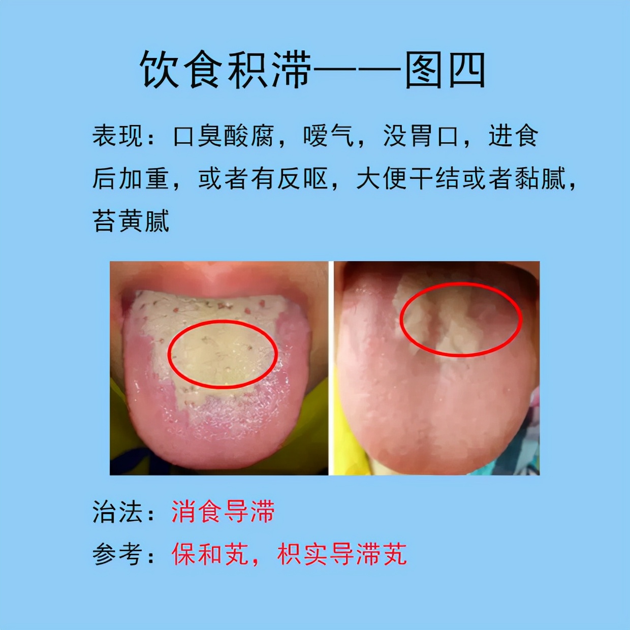 根据舌象判断用哪种调理脾胃的药,脾胃常见的症状