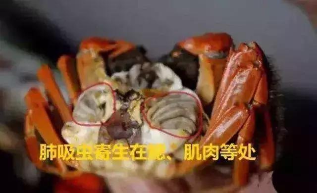 可怕男子高烧10天肝脏惊现寄生虫,男子高烧10天肝脏发现寄生虫