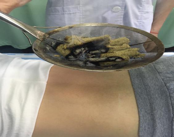 产后康复是怎么做的,中医康复和产后康复哪个最好