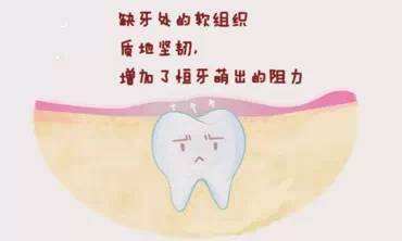 家长迟迟不肯离去老师怎么办,儿童迟迟不退牙