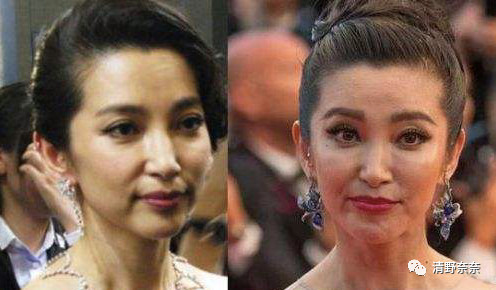 黑眼圈和眼袋可以通过眼霜消除吗,用什么样的眼霜能去除眼袋黑眼圈