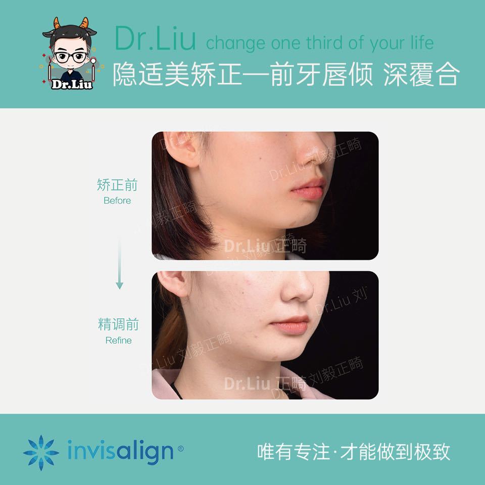 鍘﹂棬鐗欓娇缇庡,鍘﹂棬鐗欓娇鐭闅愬舰姝ｇ暩