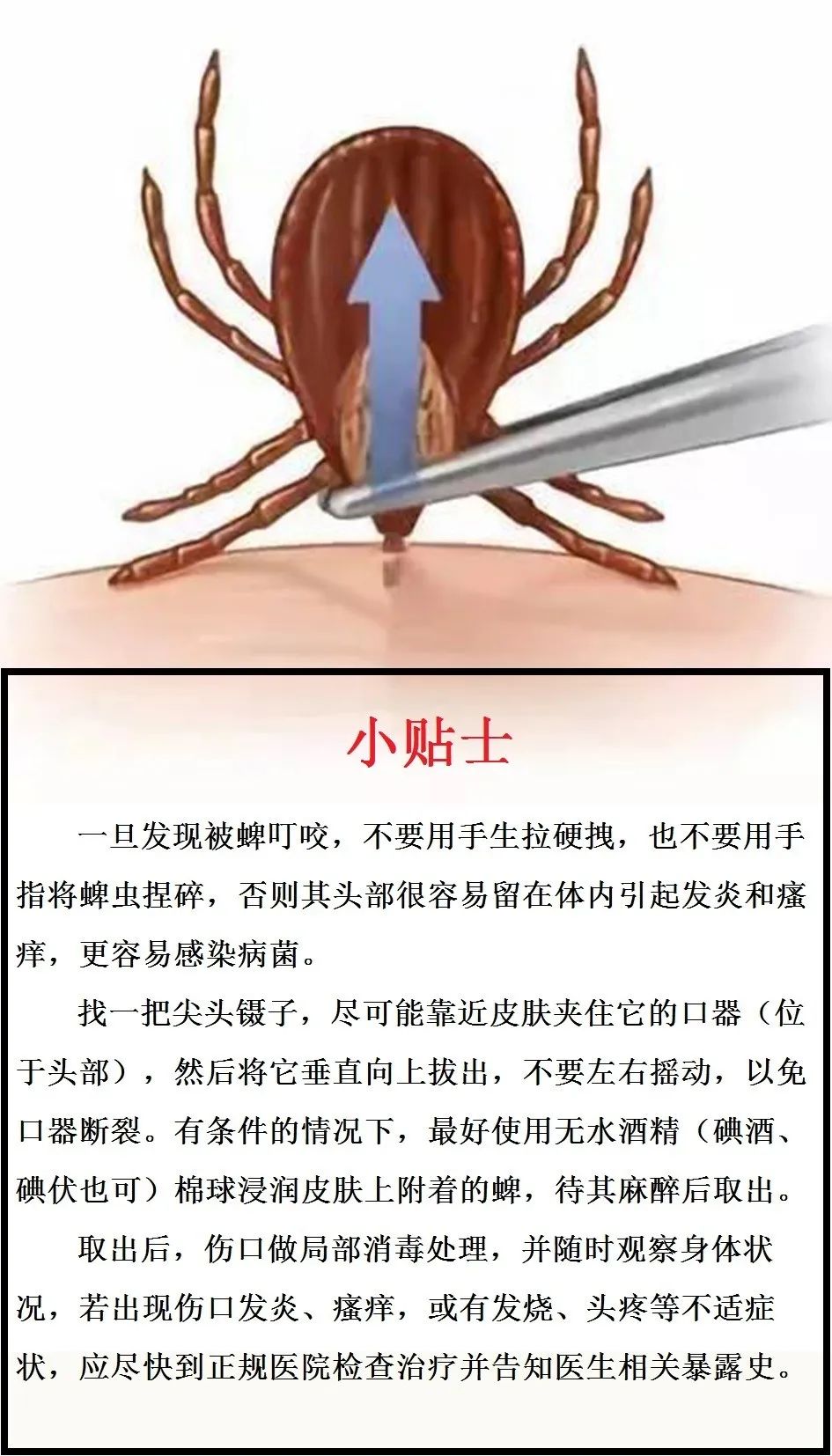 蜱虫病的发病症状,蜱虫病的病因与传染性