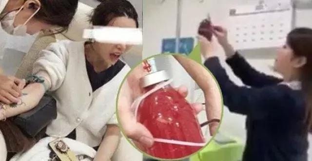 红遍朋友圈的洗血疗法，真能净化血液？背后门道很深…