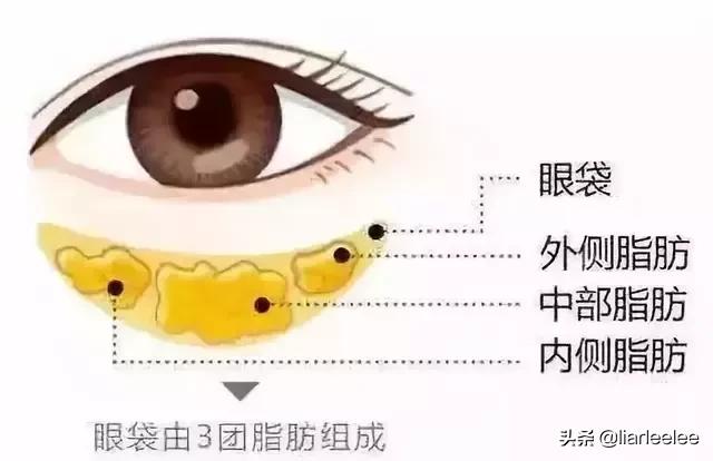 防眼角皱纹最好的方法,眼部皱纹多特别显老