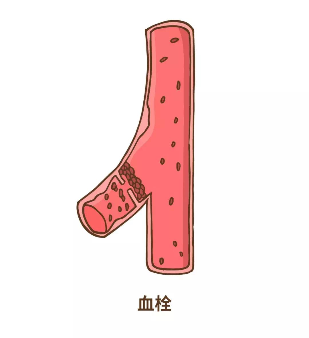 摔跤会死人吗,老年人为什么摔跤致命