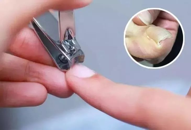 德国精工锋利指甲刀,德国顶级超薄指甲刀