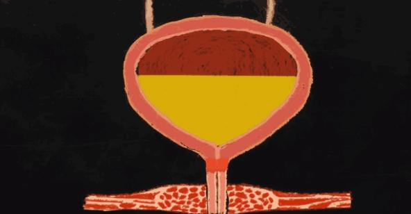 正常人憋尿多长时间有危险,防水需要注意事项