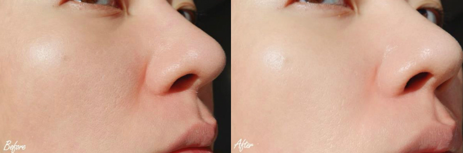 胶原蛋白精华测评对比,抗皱胶原精华测评