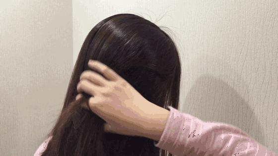 头皮屑严重如何处理好得快,头皮屑是怎么导致的如何治好