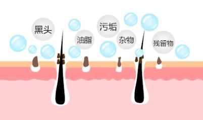 脸上毛孔粗大是什么原因引起的,脸上红血丝毛孔粗大是什么原因