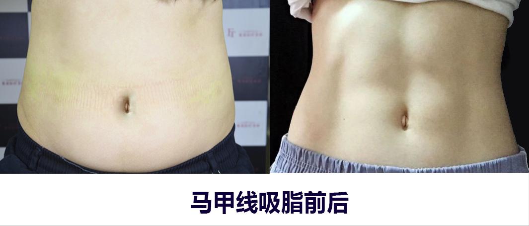 女生的马甲线男生是不是练不出来,女生马甲线多久能练好