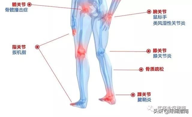 骨性关节炎诊疗方案及流程,骨性关节炎的护理诊断