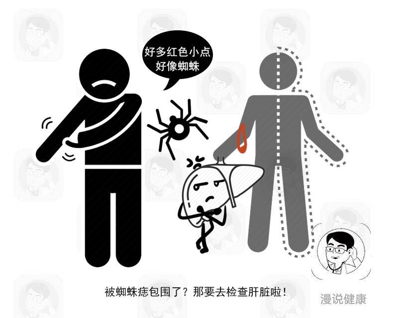 脸上长痣是癌细胞吗,皮肤上长出这3种痣千万别用手抠