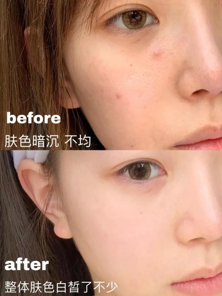 肌肤白皙的女性诱惑度比肤色黝黑的高出15.2%，变白有助于脱单