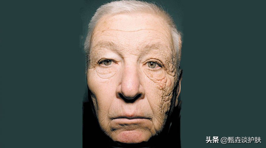 抗老化成分,抗皱抗老化的成分