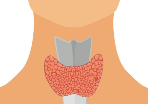 ami腺体免疫再建疗法费用,腺体修复疗法对甲亢有效果吗