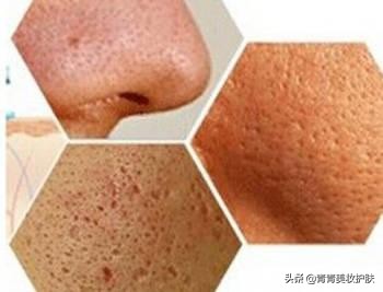 姣涘瓟绮楀ぇ濡備綍鏀瑰杽鎺ㄨ崘鏂规硶,瑙掕川灞傝杽浣嗘槸姣涘瓟绮楀ぇ濡備綍鏀瑰杽