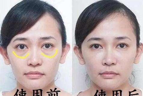眼霜涂得好真的不显老,眼霜擦与不擦有什么区别