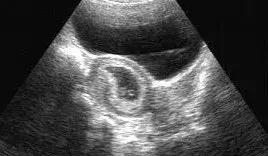 彩超怎么在屏幕上看是黑白的,为什么我的彩超是黑白色