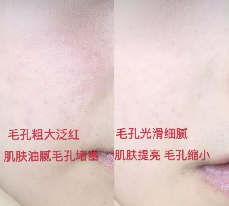 吴昕推荐的洗面奶测评,吴昕同款洗面奶pola