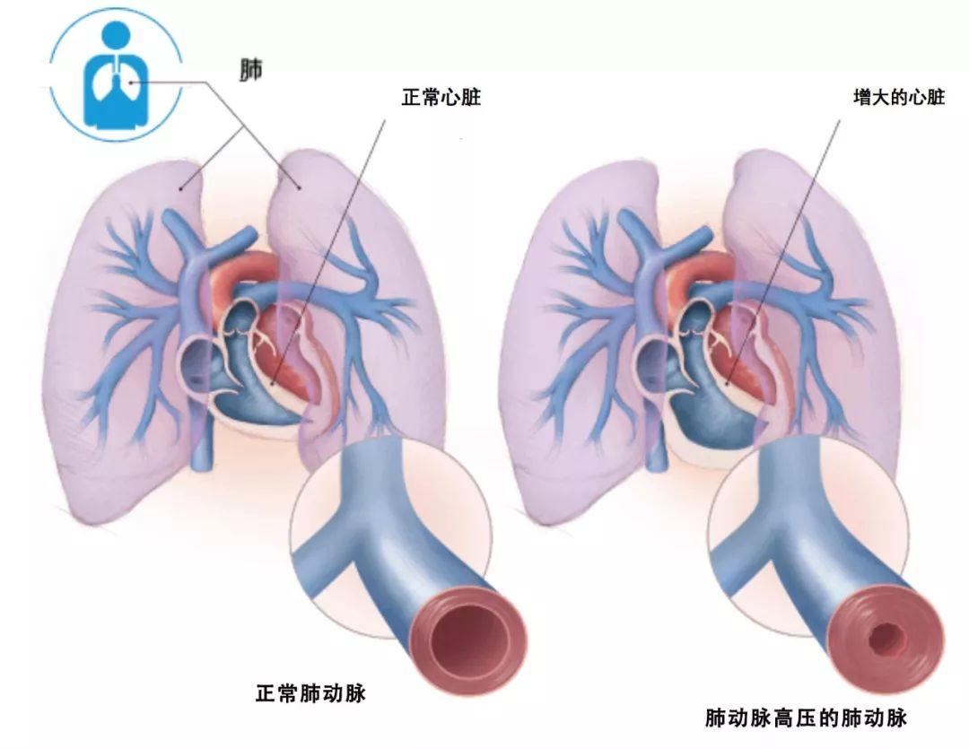 国产伟哥副作用小的有哪些,国产伟哥正确吃法和作用
