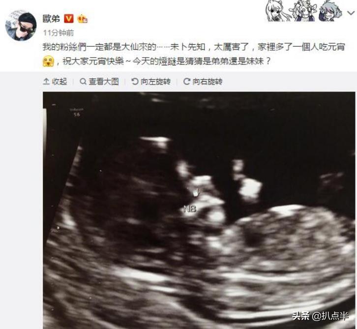 欧弟郑云灿最后一次合体亮相,郑云灿怎么追的欧弟