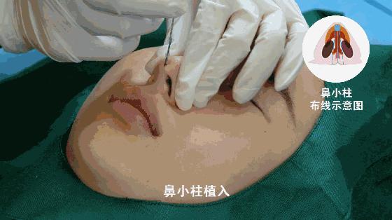 整容也就图一乐，真投胎还得买神水