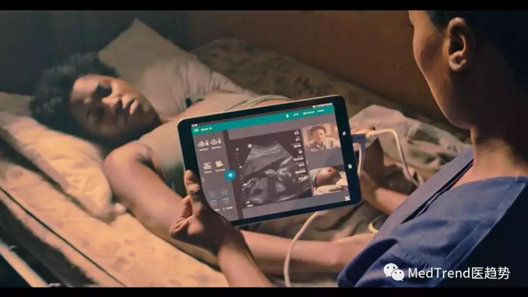 飞利浦超声探头l15-7,飞利浦超声仪器测评