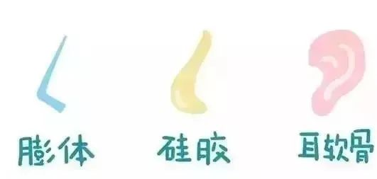 鼻整形怎么判断哪种方式适合自己,鼻整形不得不注意的几点关键因素