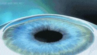 半飞秒和全飞秒多久恢复,近视半飞秒和全飞秒区别