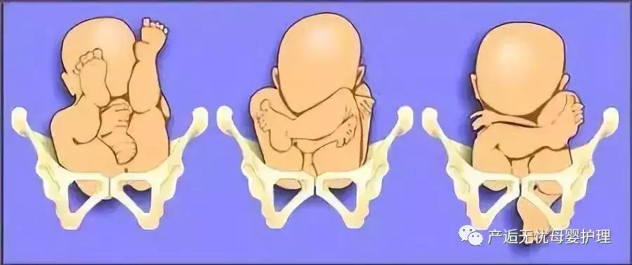 做盆骨的注意事项,怎么知道盆骨有没有达到要求