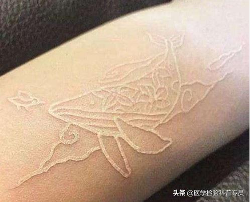 鸽子血纹身真的存在吗,鸽子血纹身真的遇热能显现吗