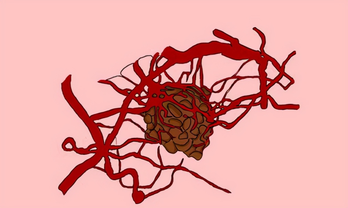 跟癌症病人吃饭一定要注意二件事,可以和癌症病人一起吃饭吗