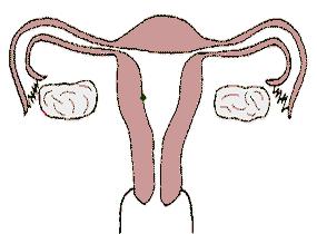 有了避孕套还需要紧急避孕药吗,紧急避孕药和避孕套哪个靠谱