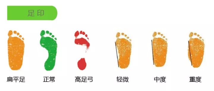 脚部足弓有啥穴位,脚底足弓是什么
