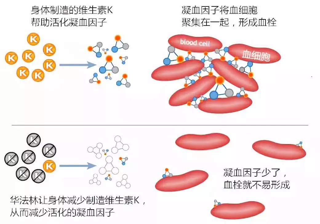 华法林，你用对了吗？