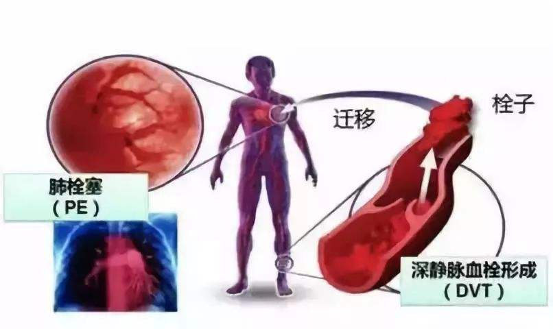 髌骨脱位症怎么治,一篇文章了解髌骨脱位及相关治疗
