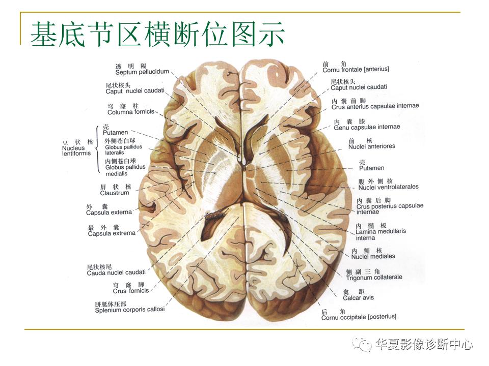 中国人脑立体定向mri应用解剖图谱,脑mri示意图