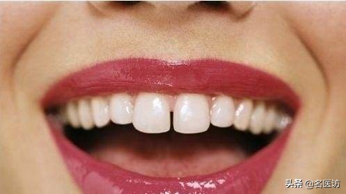 牙齿缝隙越来越大和智齿有关吗,牙齿缝隙越来越大能矫正吗