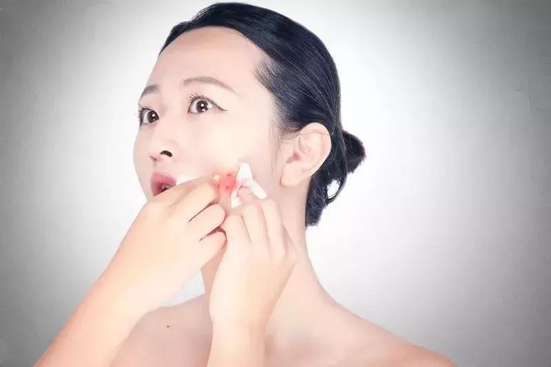 戴节育环和长痘有关系吗,淋巴长痘与肝有什么关系