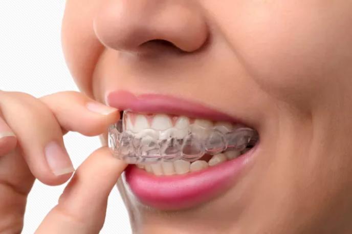 矫正牙齿透明牙套和钢丝牙套区别,钢牙和隐形牙套哪种容易有黑三角