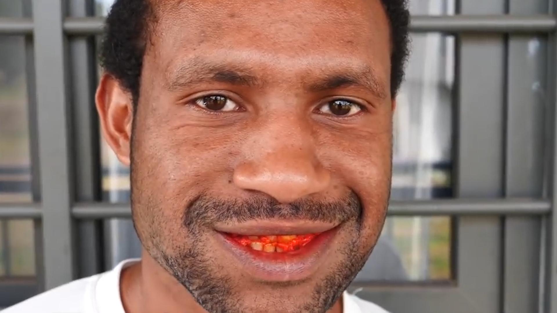 一级致癌物槟榔的危害有多大,槟榔为何致癌刷新你对槟榔的认知