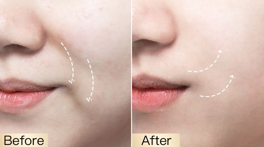 影后强势打Call！1片去浮肿、3周变紧致，大饼脸也有救了