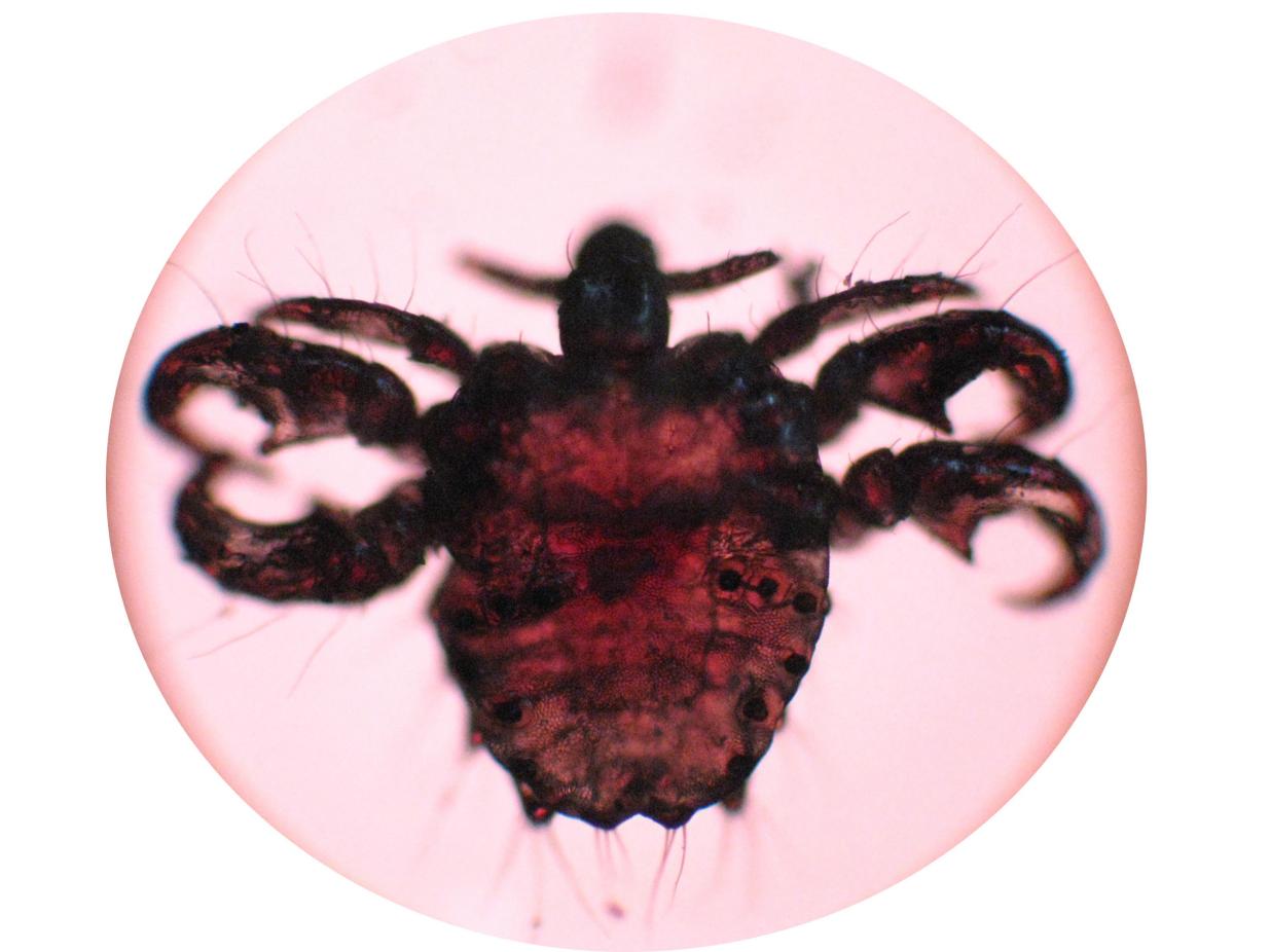 小孩眼睛痒是有虫子吗,儿童眼痒掏出六条虫