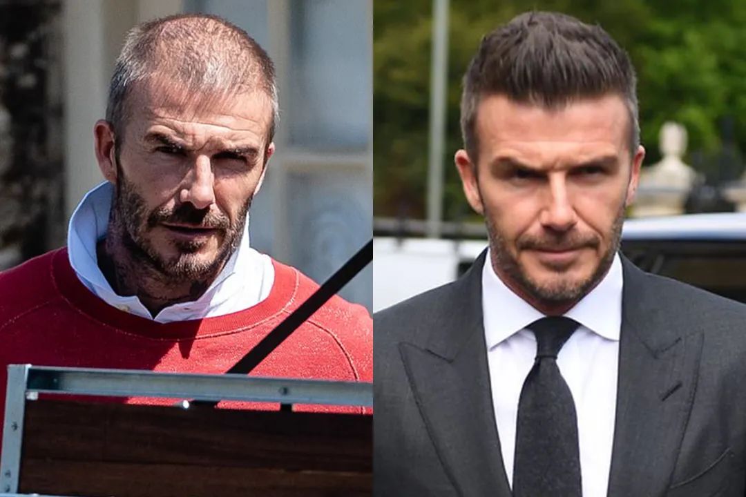 贝克汉姆最适合的发型,2001贝克汉姆寸头视频